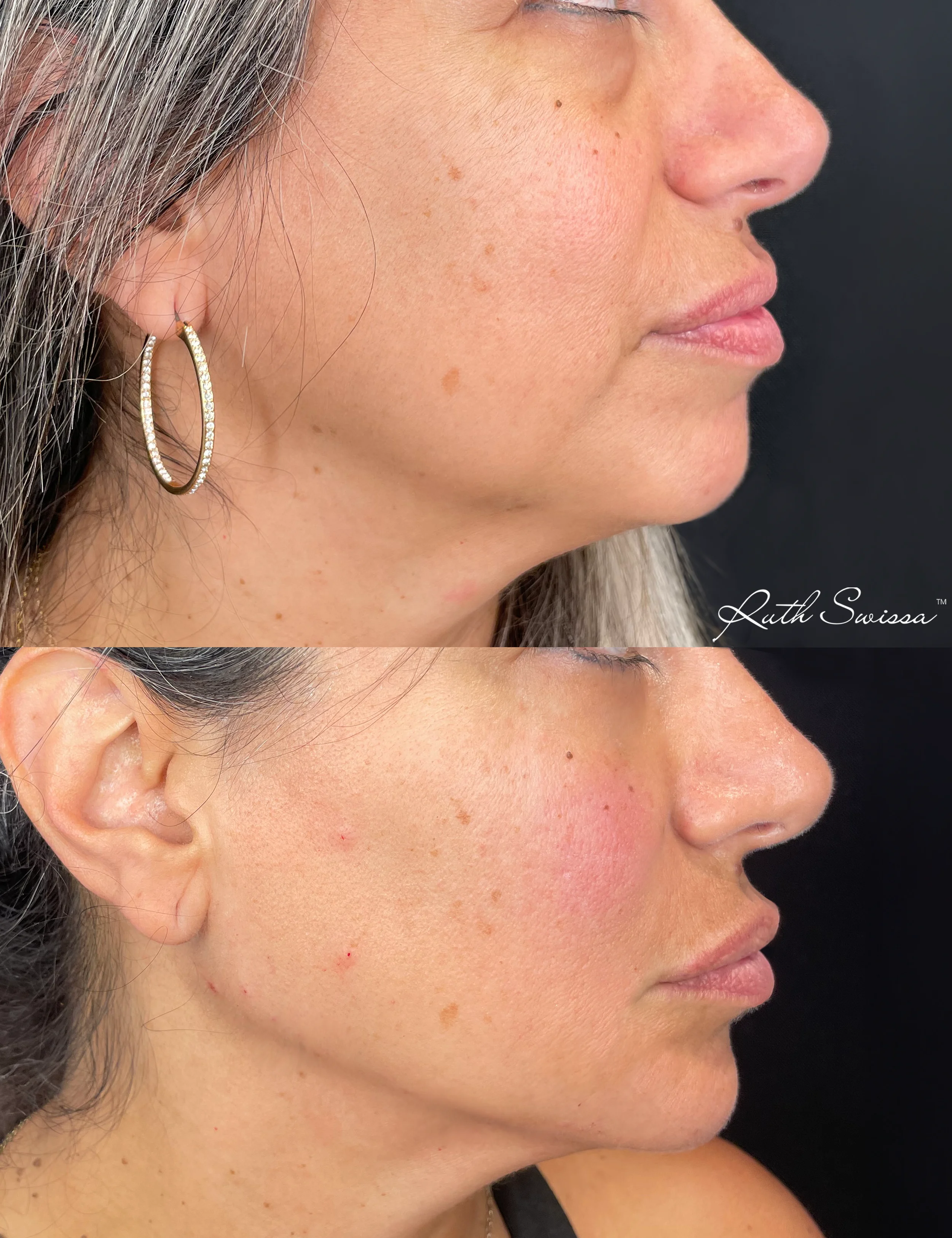 Facial balancing