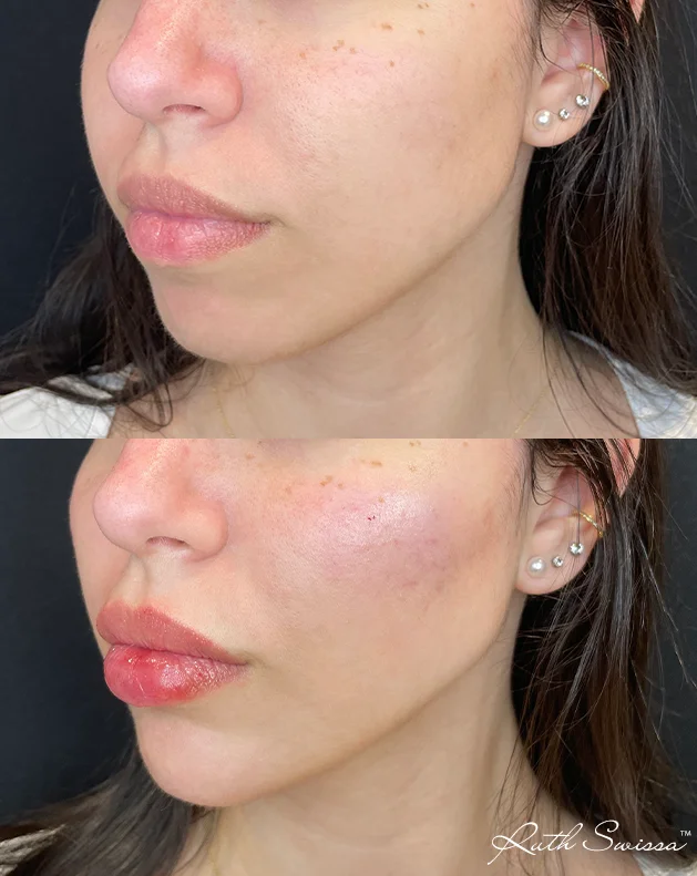 Facial balancing