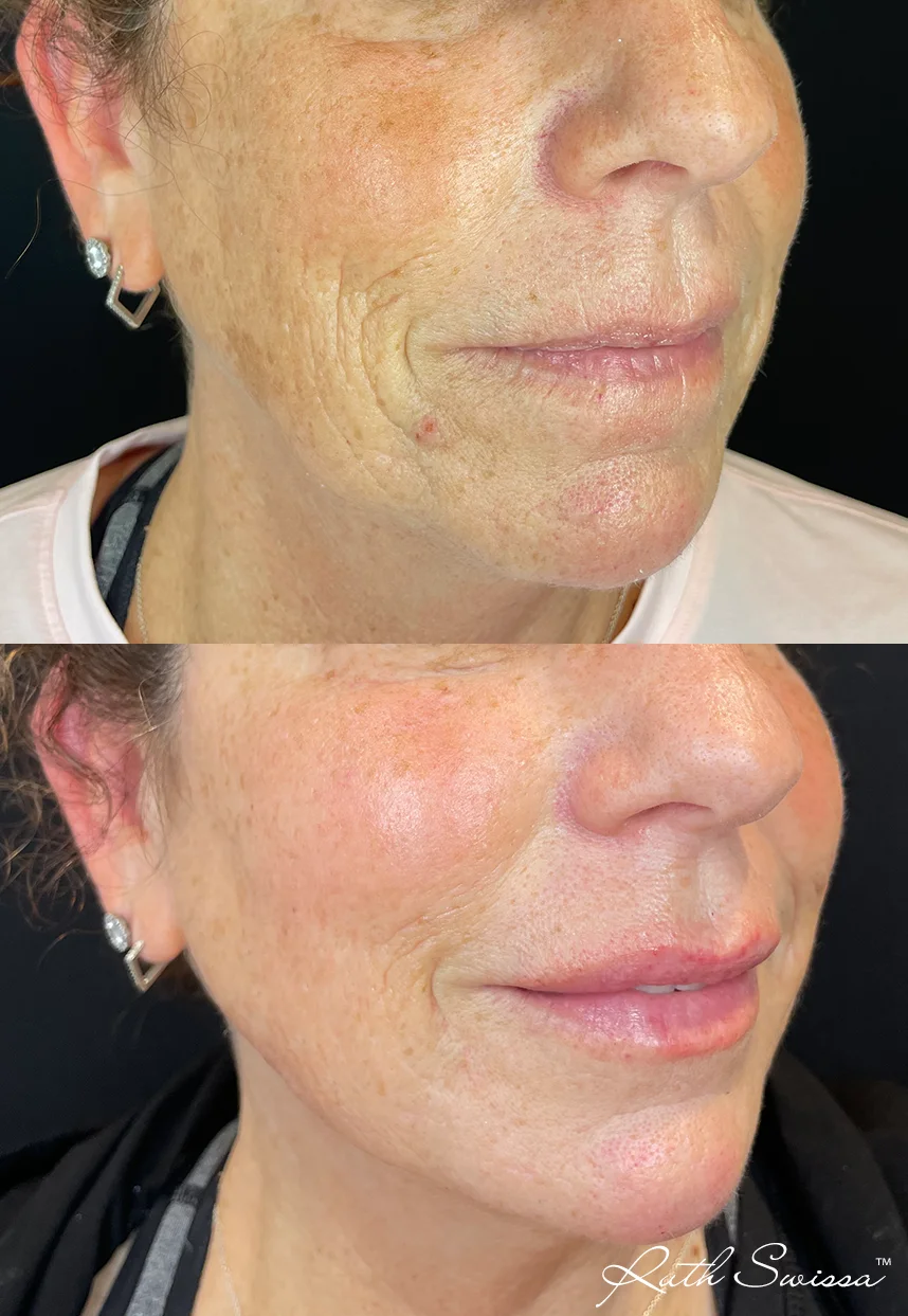 Facial balancing
