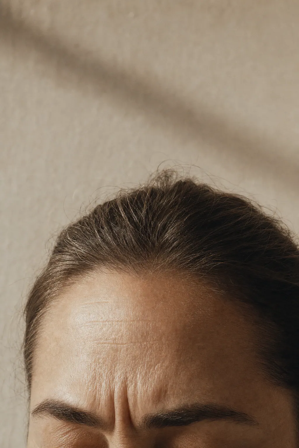 Glabella and forehead · dynamic into static