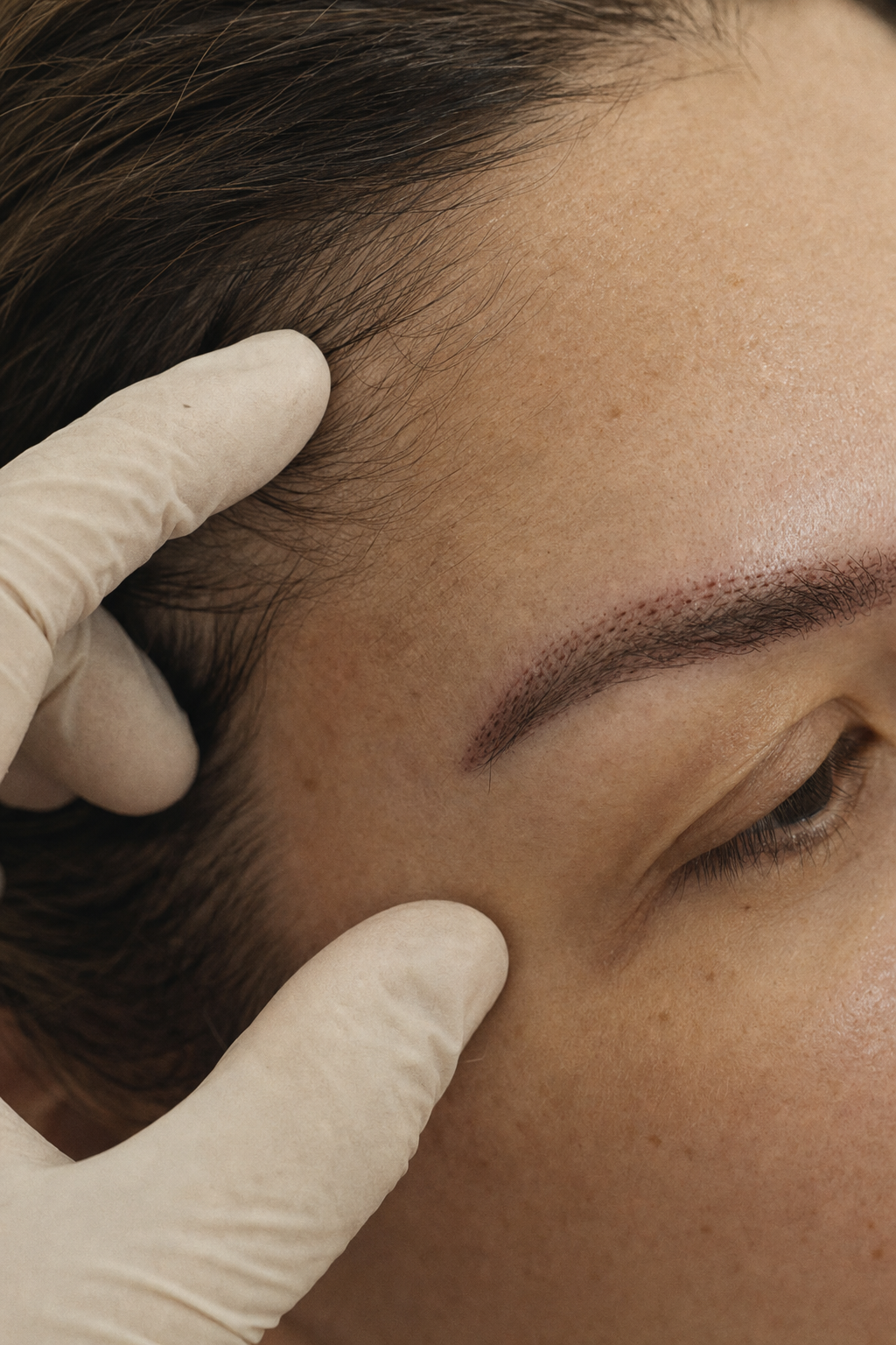 Day six · pinpoint scab pattern along the brow line